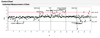 Control Chart.png